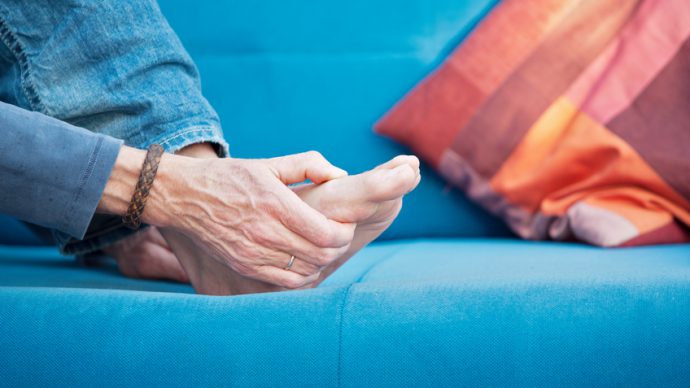 Typical gout-related pain in the metatarsophalangeal joint. XXL size image.